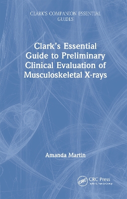 Clark’s Essential Guide to Preliminary Clinical Evaluation of Musculoskeletal X-rays by Amanda Martin