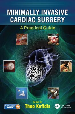 Minimally Invasive Cardiac Surgery: A Practical Guide book