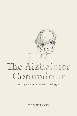 The Alzheimer Conundrum by Margaret Lock