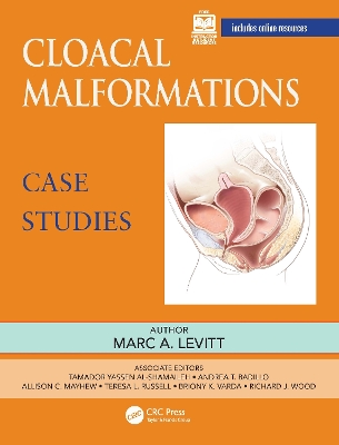 Cloacal Malformations: Case Studies by Marc Levitt