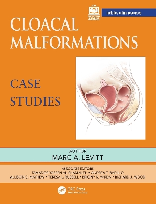 Cloacal Malformations: Case Studies book