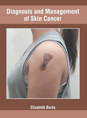 Diagnosis and Management of Skin Cancer book