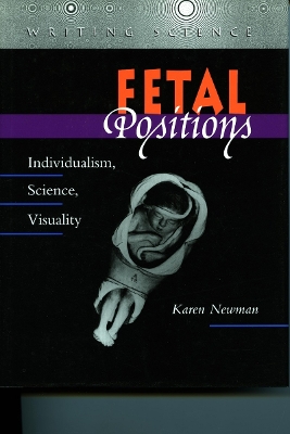 Fetal Positions by Karen Newman