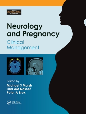 Neurology and Pregnancy: Clinical Management book