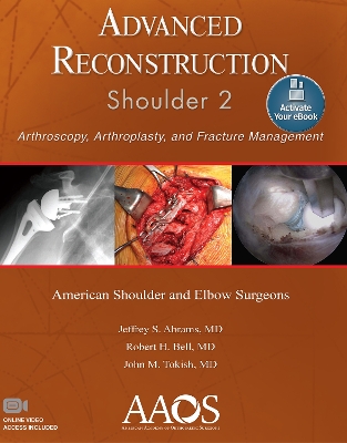 Advanced Reconstruction: Shoulder 2: Print + Ebook with Multimedia book