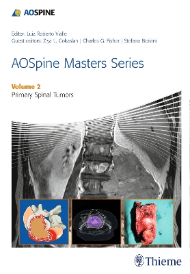 AOSpine Masters Series Volume 2: Primary Spinal Tumors book