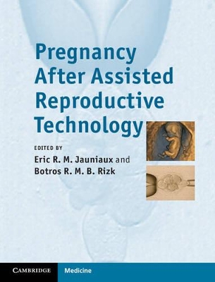 Pregnancy After Assisted Reproductive Technology book