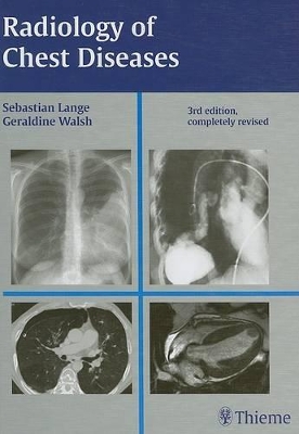 Radiology of Chest Diseases by Sebastian Lange