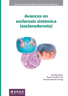 Avances en esclerosis sistémica (esclerodermia) book