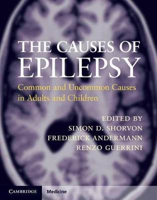 Causes of Epilepsy book