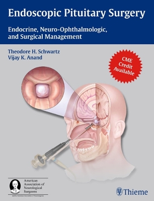 Endoscopic Pituitary Surgery book