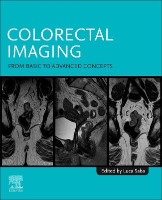 Colorectal Imaging: From Basic to Advanced Concepts book