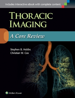 Thoracic Imaging: A Core Review by Stephen Hobbs