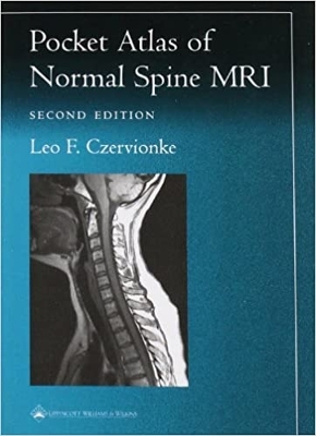 Pocket Atlas of Spinal MRI book