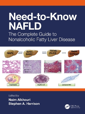 Need-to-Know NAFLD: The Complete Guide to Nonalcoholic Fatty Liver Disease by Naim Alkhouri