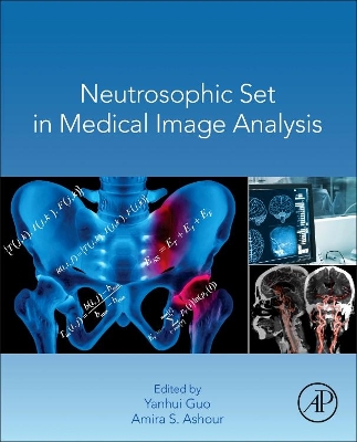 Neutrosophic Set in Medical Image Analysis book