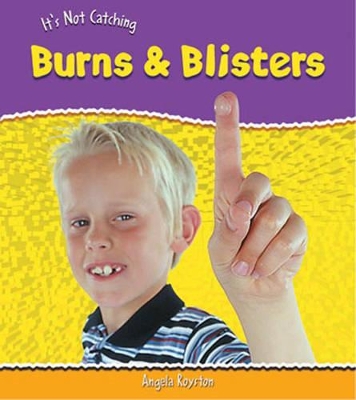 It's Not Catching: Burns And Blisters Hardback book