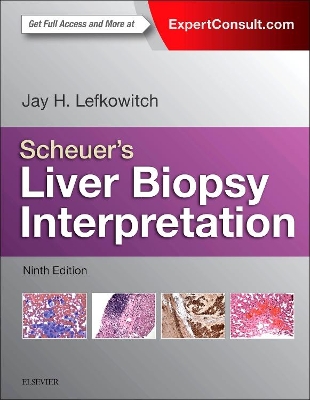 Scheuer's Liver Biopsy Interpretation by Jay H. Lefkowitch