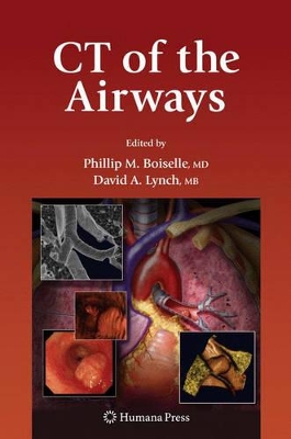 CT of the Airways book