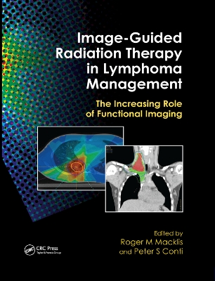 Image-Guided Radiation Therapy in Lymphoma Management: The Increasing Role of Functional Imaging by Roger M. Macklis