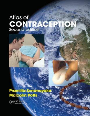 Atlas of Contraception by Pramilla Senanayake