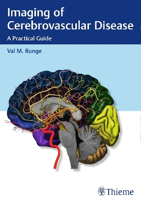 Imaging of Cerebrovascular Disease book