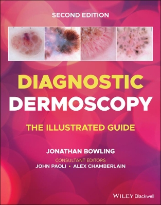 Diagnostic Dermoscopy: The Illustrated Guide book