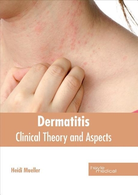 Dermatitis: Clinical Theory and Aspects book