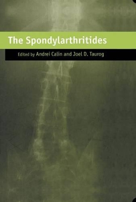 Spondylarthritides book