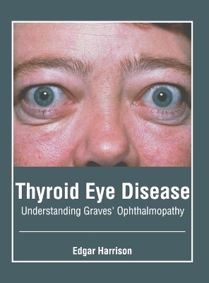 Thyroid Eye Disease: Understanding Graves' Ophthalmopathy book