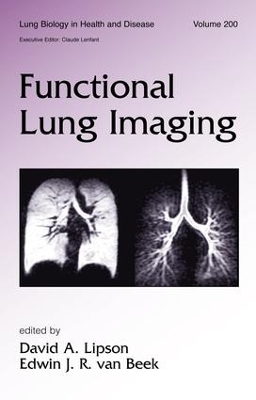 Functional Lung Imaging by David Lipson