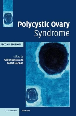 Polycystic Ovary Syndrome book