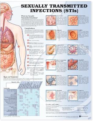 Sexually Transmitted Infections Anatomical Chart book