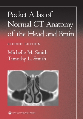 Pocket Atlas of Normal CT Anatomy of the Head and Brain book