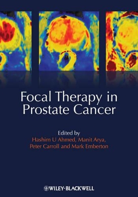 Focal Therapy in Prostate Cancer book