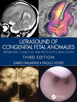 Ultrasound of Congenital Fetal Anomalies: Differential Diagnosis and Prognostic Indicators by Dario Paladini