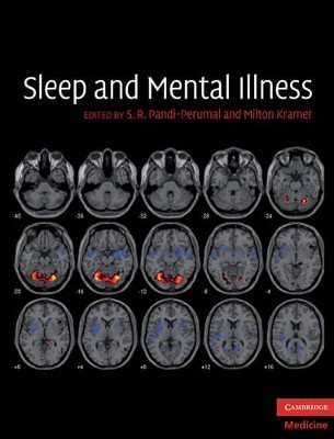 Sleep and Mental Illness book