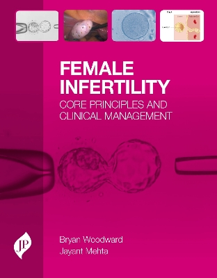 Female Infertility: Core Principles and Clinical Management book