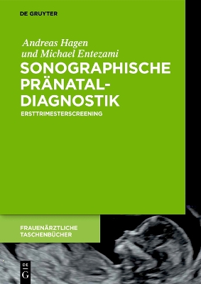 Sonographische Pränataldiagnostik: Ersttrimesterscreening book