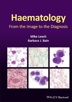 Haematology: From the Image to the Diagnosis book