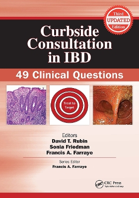 Curbside Consultation in IBD: 49 Clinical Questions book