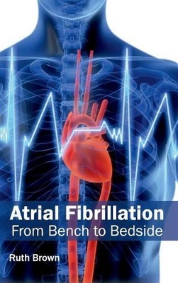 Atrial Fibrillation book