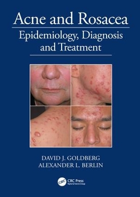 Acne and Rosacea book