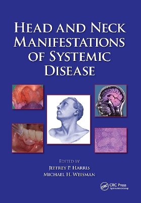 Head and Neck Manifestations of Systemic Disease by Jeffrey P. Harris
