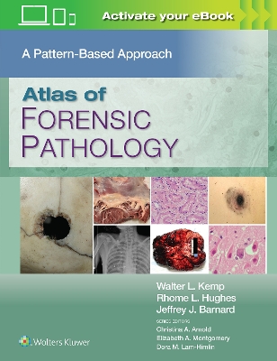 Atlas of Forensic Pathology: A Pattern Based Approach: Print + eBook with Multimedia book