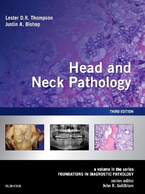 Head and Neck Pathology: A Volume in the Series: Foundations in Diagnostic Pathology by Lester D. R. Thompson