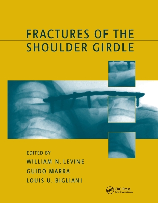 Fractures of the Shoulder Girdle by William N. Levine