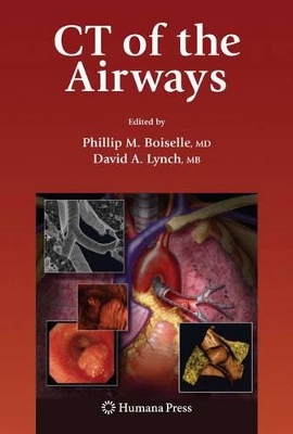 CT of the Airways by Phillip M. Boiselle