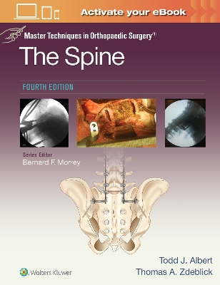 Master Techniques in Orthopaedic Surgery: The Spine by Thomas A. Zdeblick