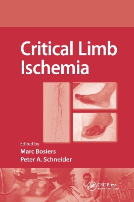 Critical Limb Ischemia by Marc Bosiers